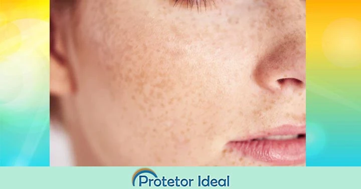 Como Escolher o Melhor Protetor Solar Para Melasma
